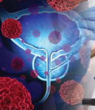 Preferentially Targets Prostate Cancer Cells
